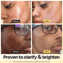 Vitamin C Clay Mask - by Gleamin