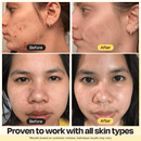 Vitamin C Clay Mask - by Gleamin
