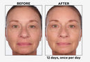 Black Rice 5-Day Brightening Serum - by Perlier