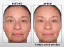 Black Rice 5-Day Brightening Serum - by Perlier